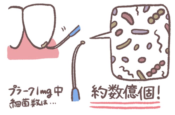 歯に付着したプラークのイメージイラスト