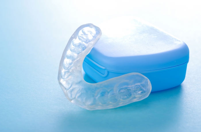 歯ぎしり・食いしばりによる歯への負担を軽減する、歯科医院で作製するナイトガード(マウスピース)